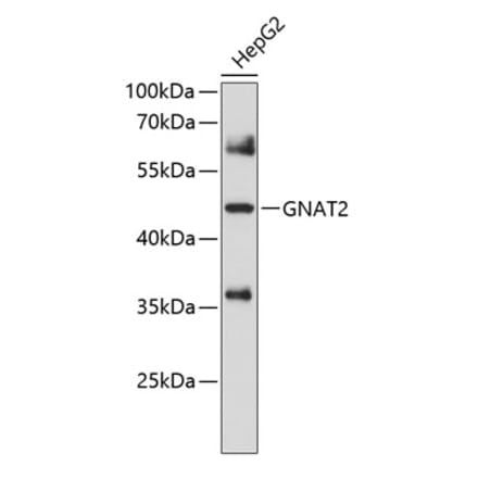 Western Blot - Anti-GNAT2 Antibody (A8591) - Antibodies.com