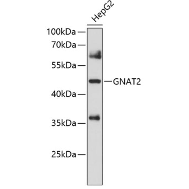 Western Blot - Anti-GNAT2 Antibody (A8591) - Antibodies.com