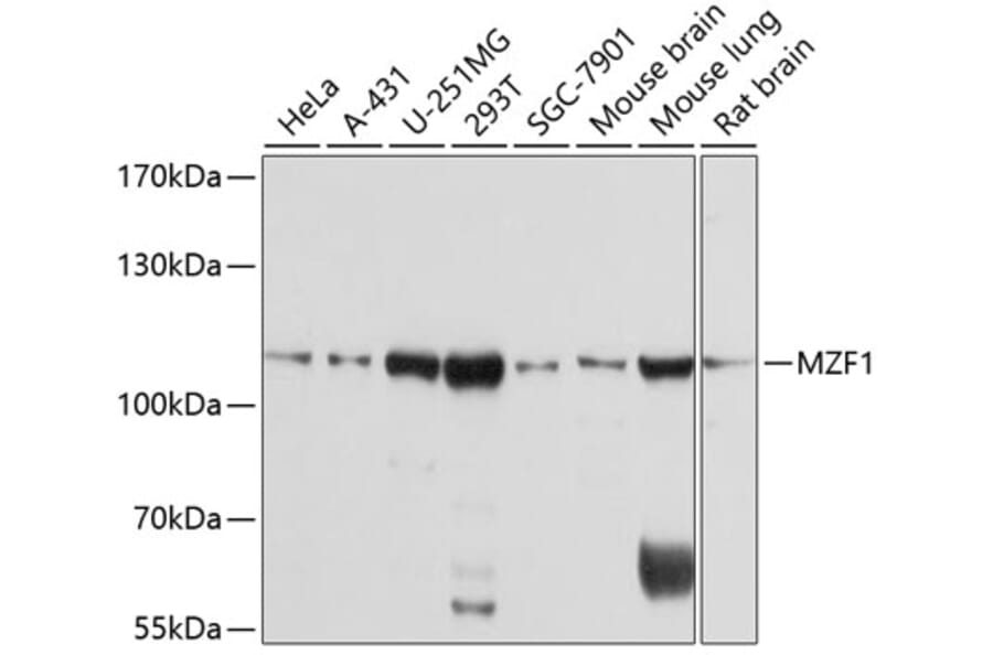 Western Blot - Anti-MZF1 Antibody (A8593) - Antibodies.com
