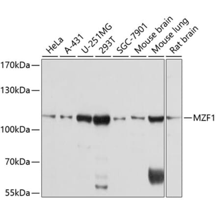 Western Blot - Anti-MZF1 Antibody (A8593) - Antibodies.com