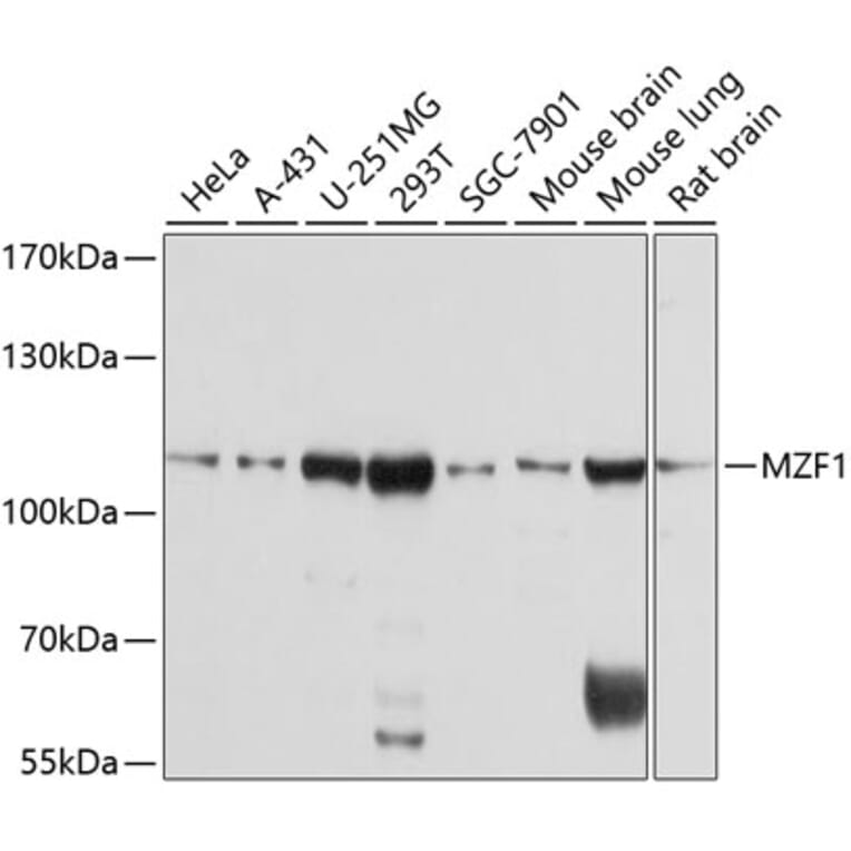 Western Blot - Anti-MZF1 Antibody (A8593) - Antibodies.com