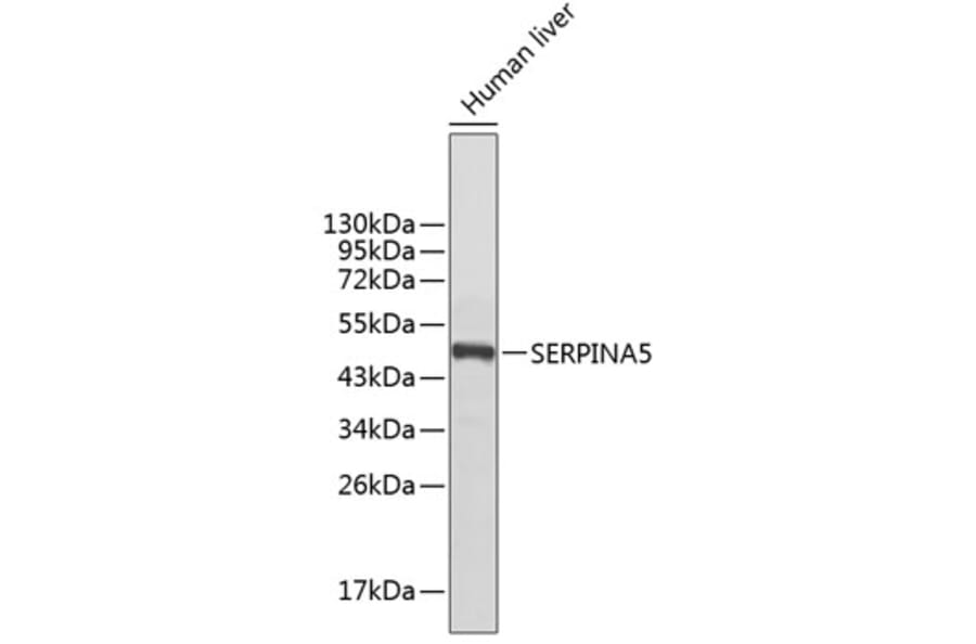 Western Blot - Anti-SERPINA5 Antibody (A1036) - Antibodies.com