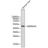 Western Blot - Anti-SERPINA5 Antibody (A1036) - Antibodies.com