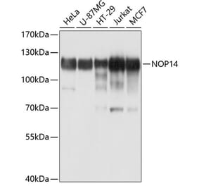 Western Blot - Anti-NOP14 Antibody (A10361) - Antibodies.com