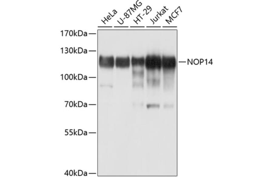 Western Blot - Anti-NOP14 Antibody (A10361) - Antibodies.com
