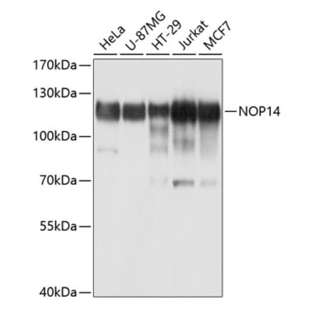 Western Blot - Anti-NOP14 Antibody (A10361) - Antibodies.com