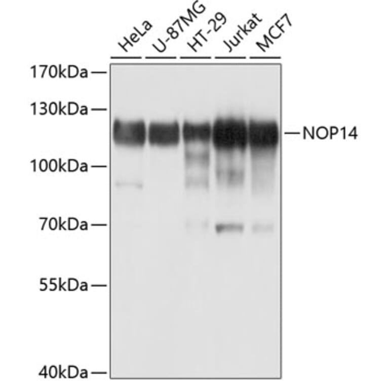 Western Blot - Anti-NOP14 Antibody (A10361) - Antibodies.com