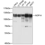 Western Blot - Anti-NOP14 Antibody (A10361) - Antibodies.com