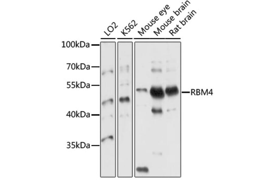 Western Blot - Anti-RBM4 Antibody (A10362) - Antibodies.com