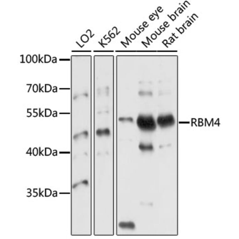 Western Blot - Anti-RBM4 Antibody (A10362) - Antibodies.com