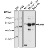 Western Blot - Anti-RBM4 Antibody (A10362) - Antibodies.com