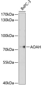Western blot analysis of extracts of BxPC-3 cells, using Anti-AOAH Antibody (A10366) at 1:1,000 dilution.
Secondary antibody: Goat Anti-Rabbit IgG (H+L) (HRP) (AS014) at 1:10,000 dilution.
Lysates / proteins: 25µg per lane.
Blocking buffer: 3% non-fat dry milk in TBST.
Detection: ECL Basic Kit (RM00020).
Exposure time: 30s.