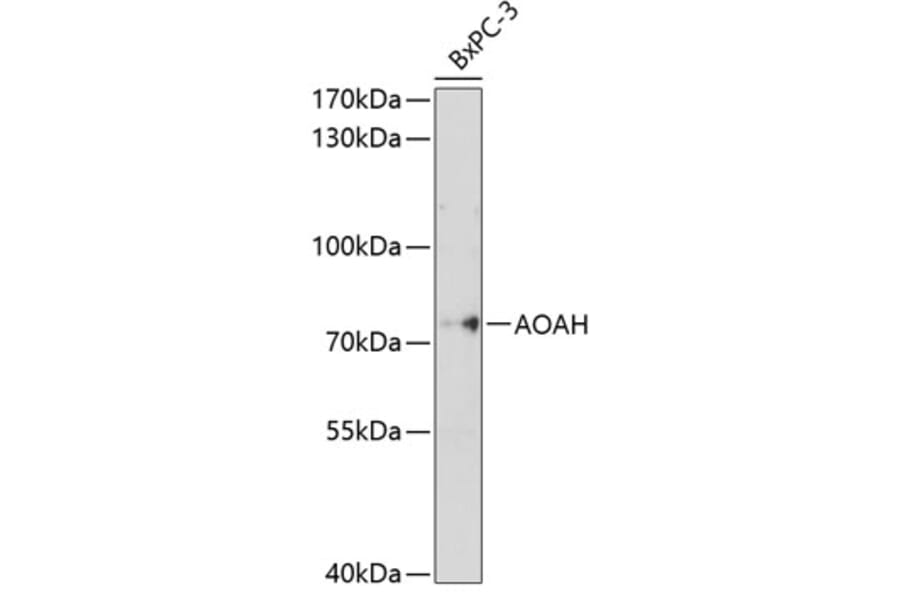 Western Blot - Anti-Acyloxyacyl Hydrolase Antibody (A8597) - Antibodies.com