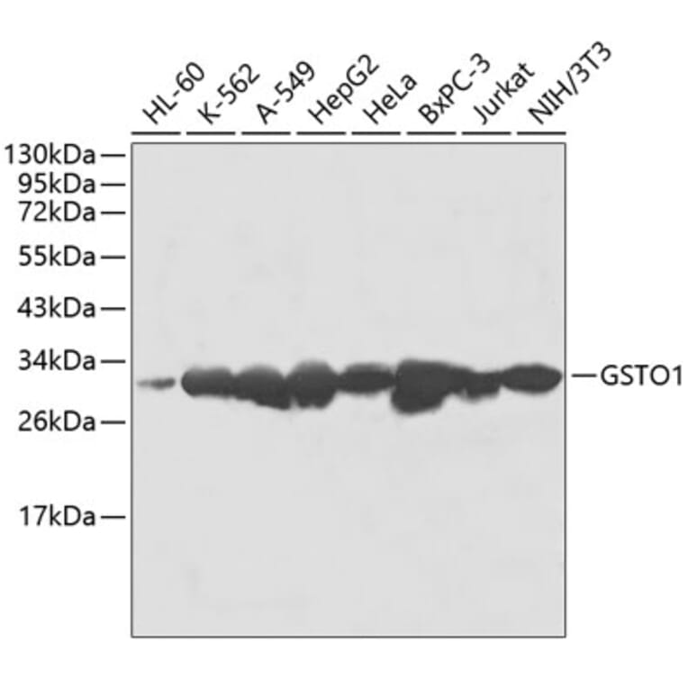 Western Blot - Anti-GSTO1 Antibody (A1037) - Antibodies.com