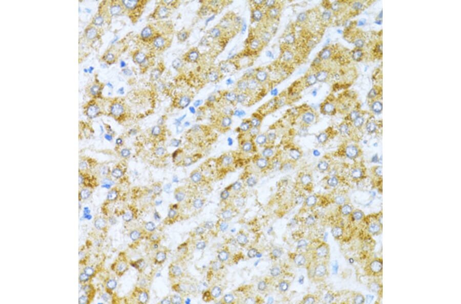 Immunohistochemistry - Anti-KLHL42 Antibody (A8599) - Antibodies.com