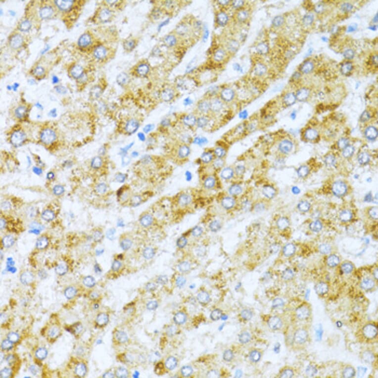 Immunohistochemistry - Anti-KLHL42 Antibody (A8599) - Antibodies.com