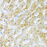 Immunohistochemistry - Anti-KLHL42 Antibody (A8599) - Antibodies.com