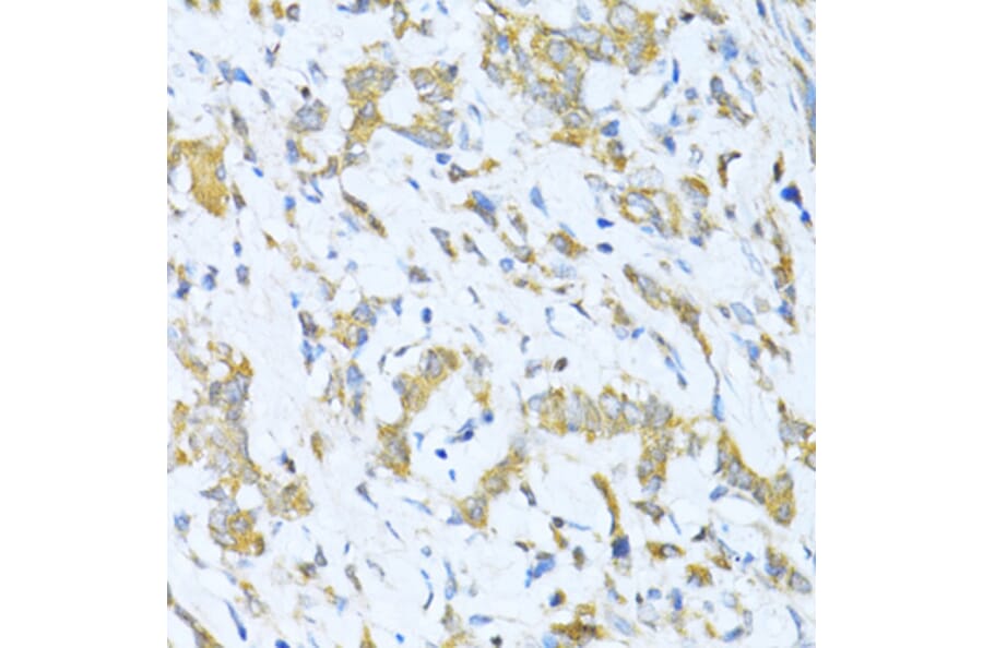 Immunohistochemistry - Anti-KLHL42 Antibody (A8599) - Antibodies.com
