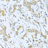 Immunohistochemistry - Anti-KLHL42 Antibody (A8599) - Antibodies.com