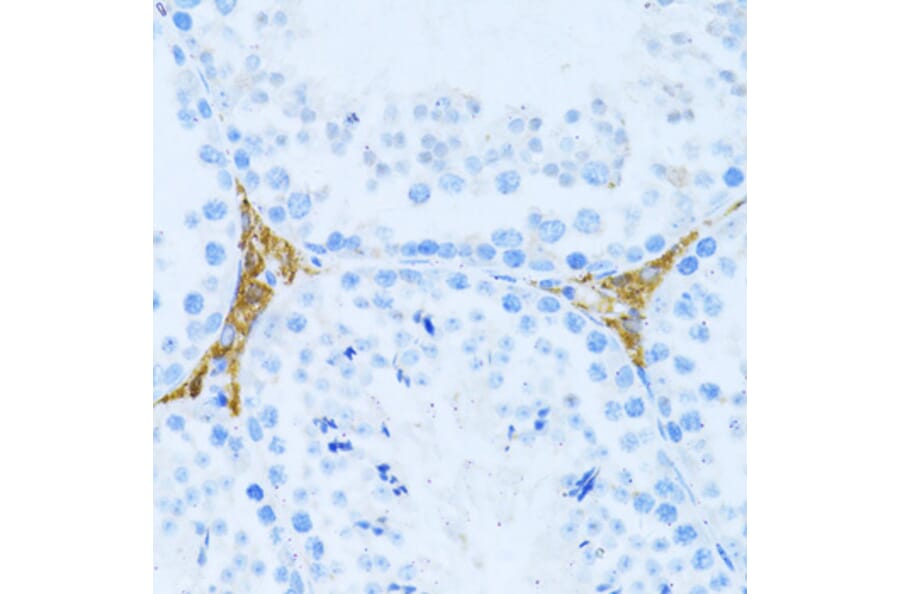Immunohistochemistry - Anti-KLHL42 Antibody (A8599) - Antibodies.com