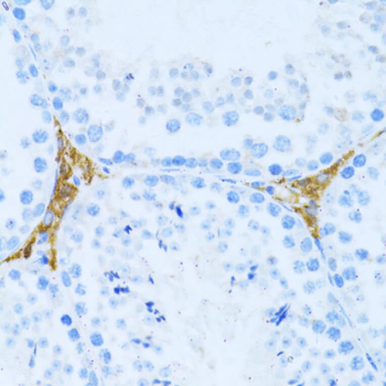 Immunohistochemistry - Anti-KLHL42 Antibody (A8599) - Antibodies.com