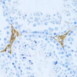 Immunohistochemistry - Anti-KLHL42 Antibody (A8599) - Antibodies.com