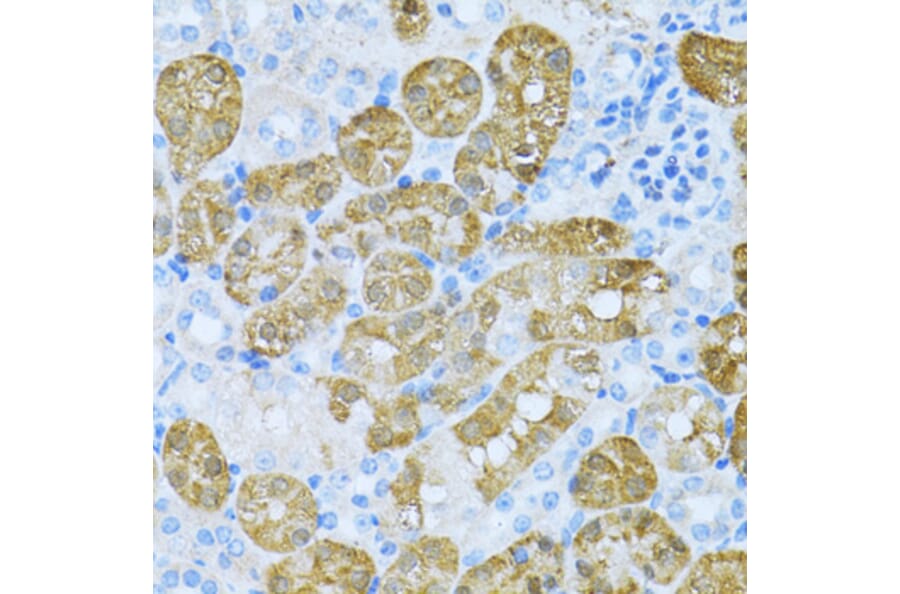 Immunohistochemistry - Anti-KLHL42 Antibody (A8599) - Antibodies.com