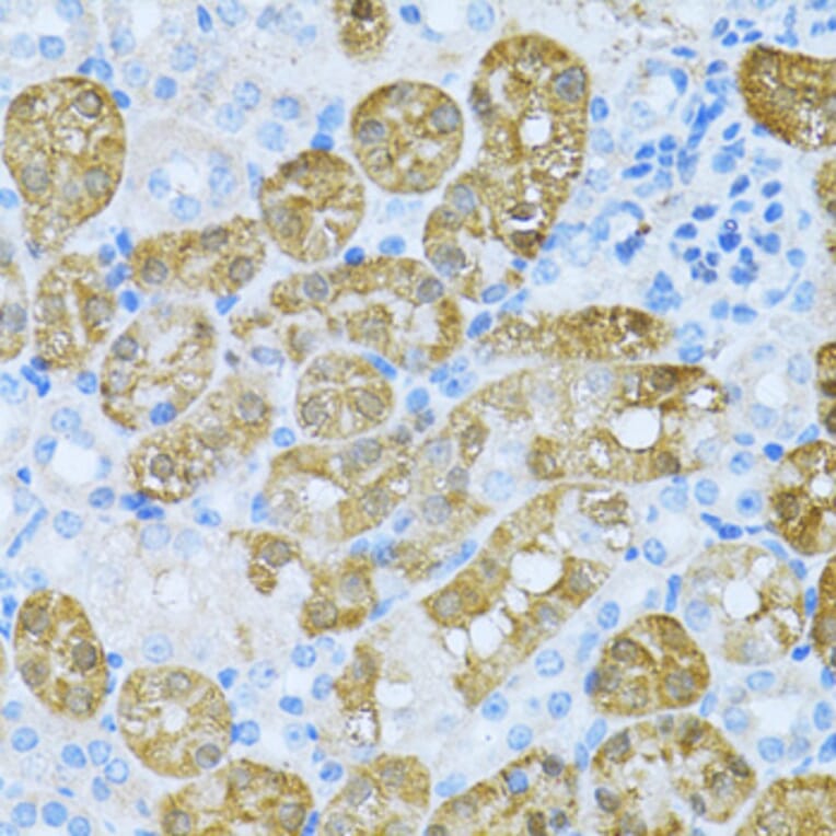 Immunohistochemistry - Anti-KLHL42 Antibody (A8599) - Antibodies.com