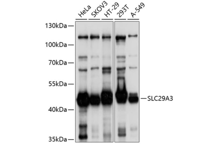 Western Blot - Anti-SLC29A3/ENT3 Antibody (A8600) - Antibodies.com