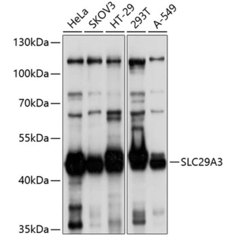 Western Blot - Anti-SLC29A3/ENT3 Antibody (A8600) - Antibodies.com