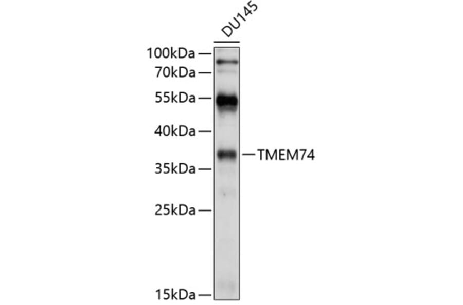 Western Blot - Anti-TMEM74 Antibody (A8602) - Antibodies.com