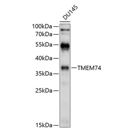 Western Blot - Anti-TMEM74 Antibody (A8602) - Antibodies.com