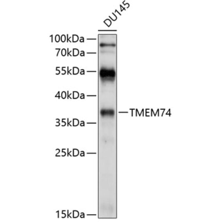 Western Blot - Anti-TMEM74 Antibody (A8602) - Antibodies.com