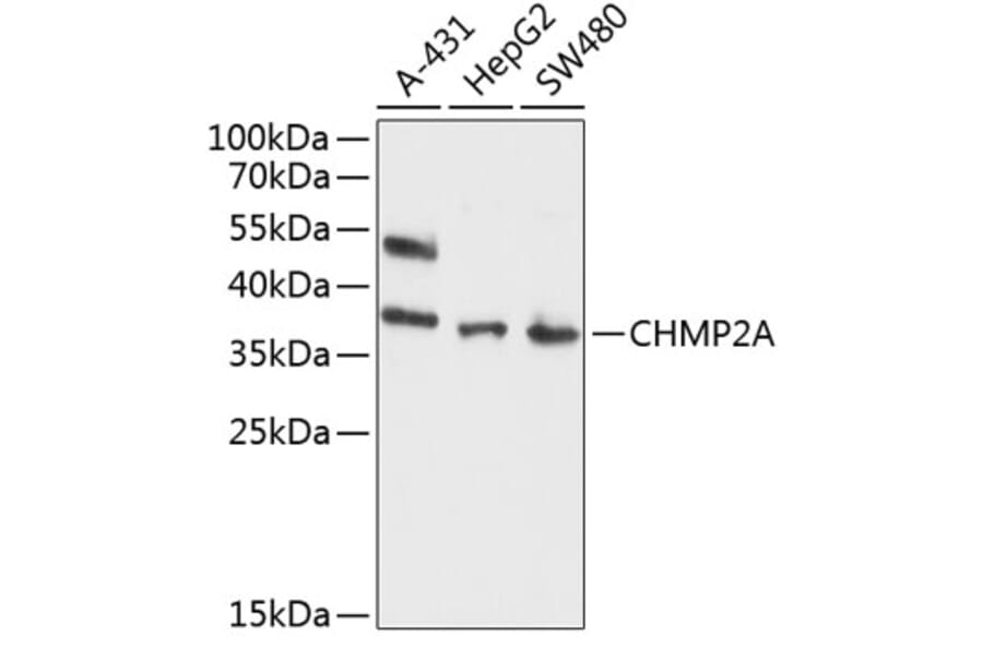 Western Blot - Anti-CHMP2A/BC2 Antibody (A8603) - Antibodies.com