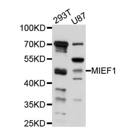 Western Blot - Anti-MIEF1 Antibody (A10396) - Antibodies.com