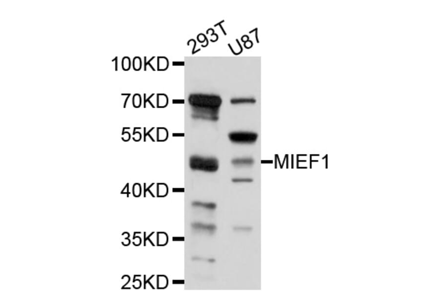 Western Blot - Anti-MIEF1 Antibody (A10396) - Antibodies.com