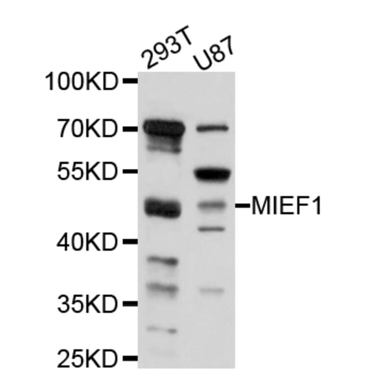 Western Blot - Anti-MIEF1 Antibody (A10396) - Antibodies.com
