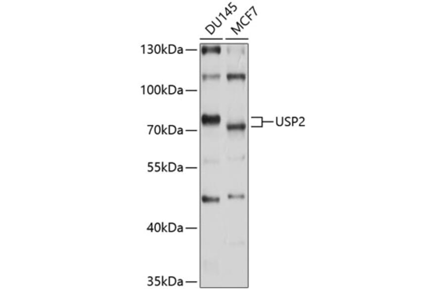 Western Blot - Anti-USP2 Antibody (A8605) - Antibodies.com