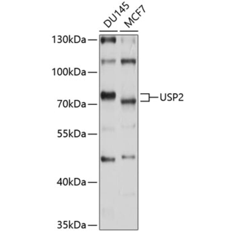 Western Blot - Anti-USP2 Antibody (A8605) - Antibodies.com