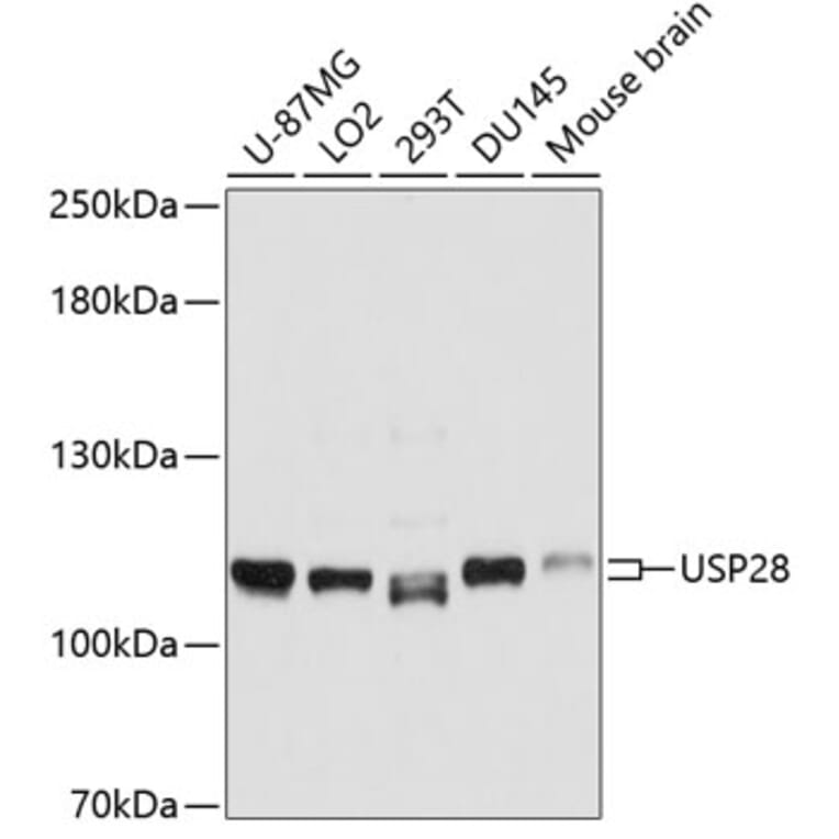 Western Blot - Anti-USP28 Antibody (A10400) - Antibodies.com