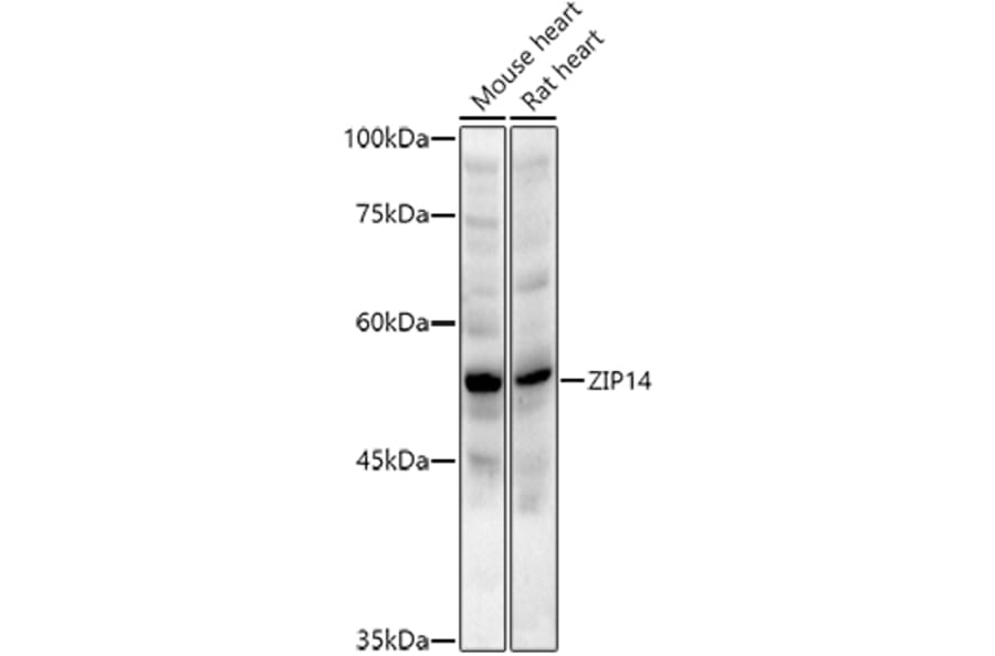 Western Blot - Anti-SLC39A14/ZIP-14 Antibody (A8608) - Antibodies.com