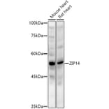 Western Blot - Anti-SLC39A14/ZIP-14 Antibody (A8608) - Antibodies.com