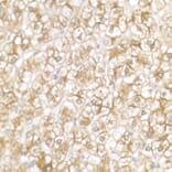 Immunohistochemistry - Anti-SLC39A14/ZIP-14 Antibody (A8608) - Antibodies.com