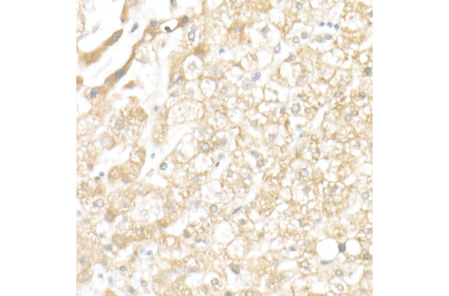 Immunohistochemistry - Anti-SLC39A14/ZIP-14 Antibody (A8608) - Antibodies.com
