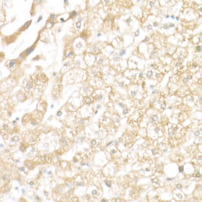 Immunohistochemistry - Anti-SLC39A14/ZIP-14 Antibody (A8608) - Antibodies.com