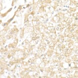 Immunohistochemistry - Anti-SLC39A14/ZIP-14 Antibody (A8608) - Antibodies.com