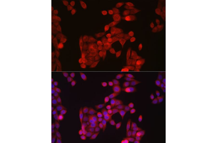 Immunofluorescence - Anti-SLC39A14/ZIP-14 Antibody (A8608) - Antibodies.com
