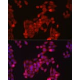 Immunofluorescence - Anti-SLC39A14/ZIP-14 Antibody (A8608) - Antibodies.com