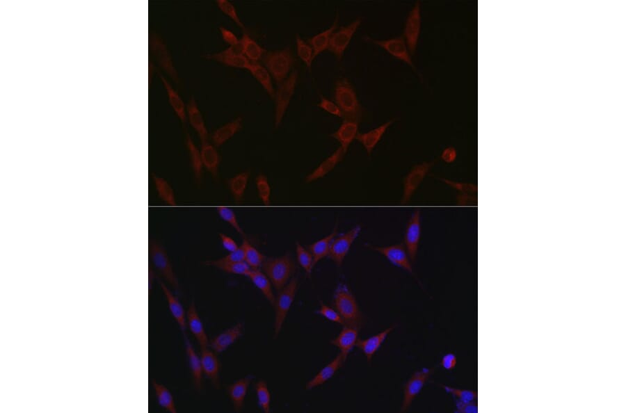 Immunofluorescence - Anti-SLC39A14/ZIP-14 Antibody (A8608) - Antibodies.com
