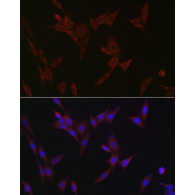 Immunofluorescence - Anti-SLC39A14/ZIP-14 Antibody (A8608) - Antibodies.com
